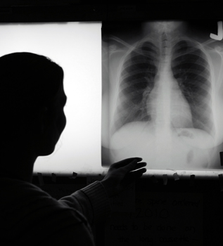 Ex Vivo Transplants Give Rejected Lungs New Life Ex Vivo Transplants Give Rejected Lungs New Life
