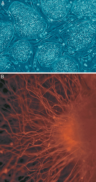 Neural Stem Cells Show Promise In Treating Rare Brain Disease Neural Stem Cells Show Promise In Treating Rare Brain Disease