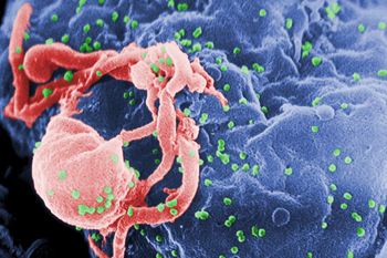 HIV/AIDS Becomes Different Kind of Disease for Survivors HIV/AIDS Becomes Different Kind of Disease for Survivors