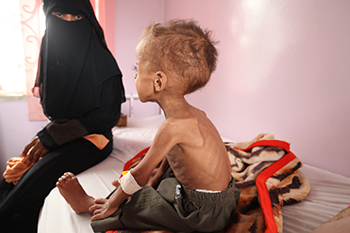 World Turns Blind Eye to Yemen’s Civil War, Rohingya Refugees and South Sudan’s Famine World Turns Blind Eye to Yemen’s Civil War, Rohingya Refugees and South Sudan’s Famine