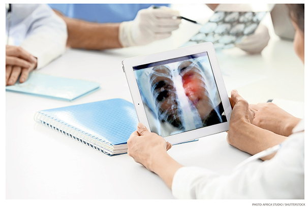 New Drugs May Be Big Advance in Lung Cancer Care New Drugs May Be Big Advance in Lung Cancer Care