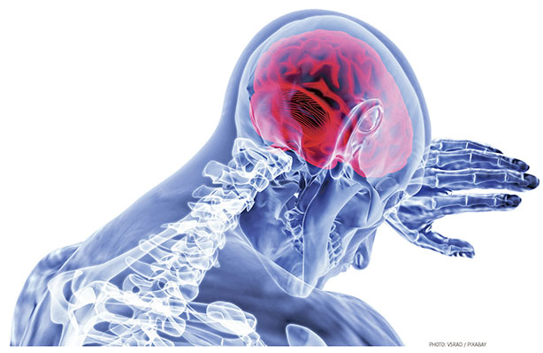 Depression, Alzheimer’s Might Be Part of Same Process in Some Aging Brains Depression, Alzheimer’s Might Be Part of Same Process in Some Aging Brains